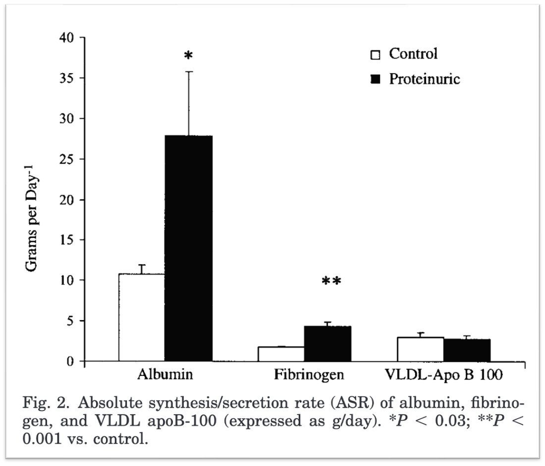 1/12 🤔Why is plasma albumin low in nephrotic syndrome? "Urinary losses
