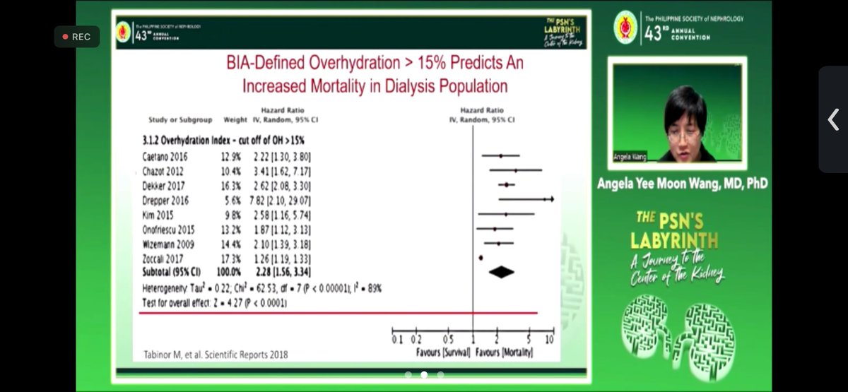 NephroPOCUS on Twitter "Bioimpedance defined over hydration predicts