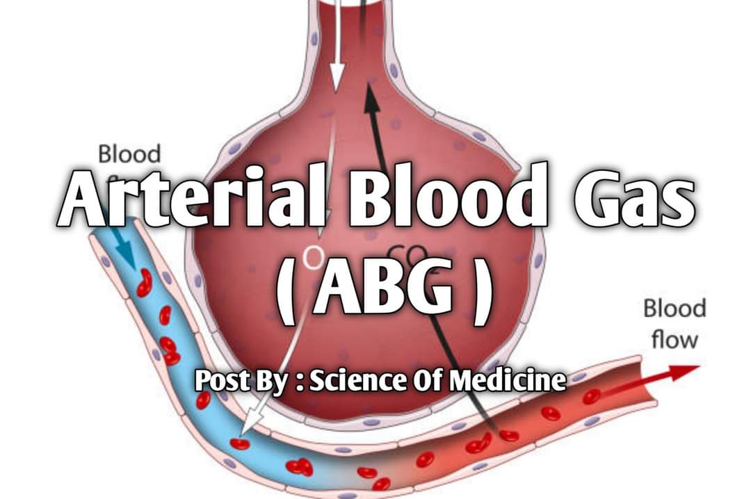 ravirajyadv143's tweet image. Arterial Blood Gases #ABGs
#medicalstudent #learningtricks