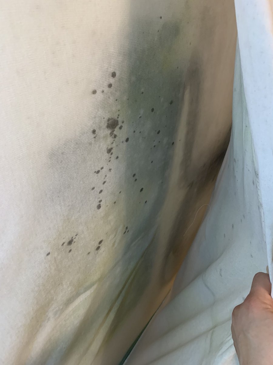 OjosMudos's tweet photo. Compré hace 10 meses un colchón @TempurPedic @TempurUK que garantizan 10 años en California $2600 dls y se ha llenado de moho.  Alguna solución ? https://t.co/AxC9d5nvIO