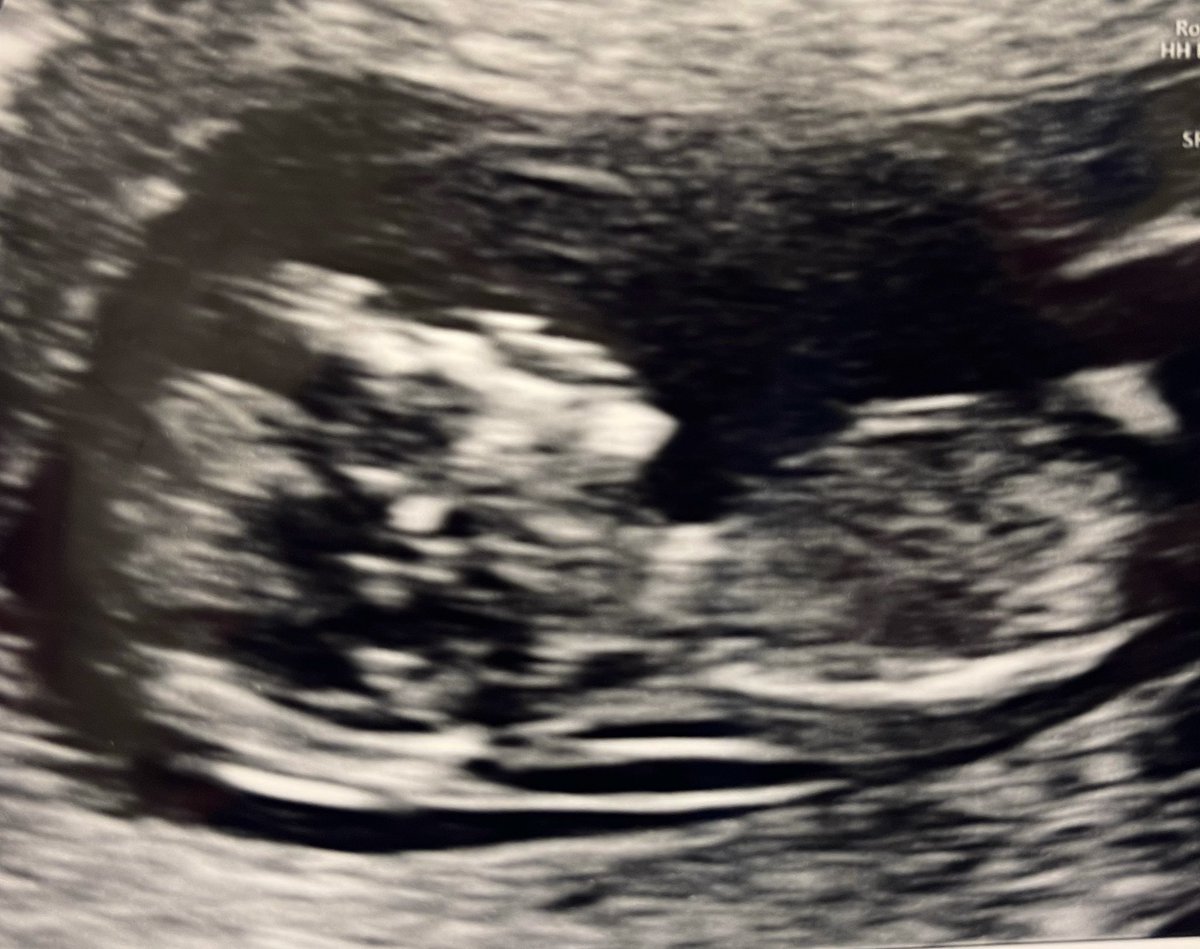 4njM95's tweet photo. Baby Foster coming soon 🌈🫶🏻 https://t.co/0L44RlvZxd