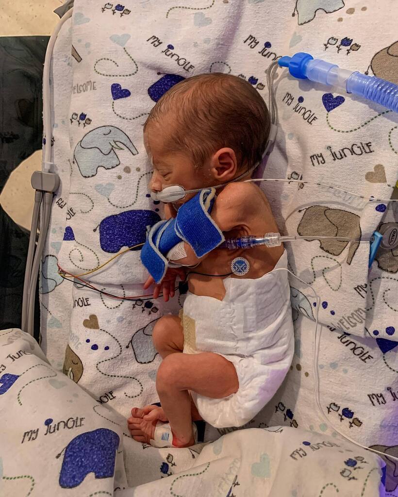 Zion David Mac Millan 
Arriving on the 26th of April at 33 weeks, 1.45kgs and ridiculously handsome, our baby boy’s been teaching us about miracles. 

We’ve only known the peace and kindness of Heaven over the last few days and seen wonder in every momen… instagr.am/p/CrnWoTdqQkO/