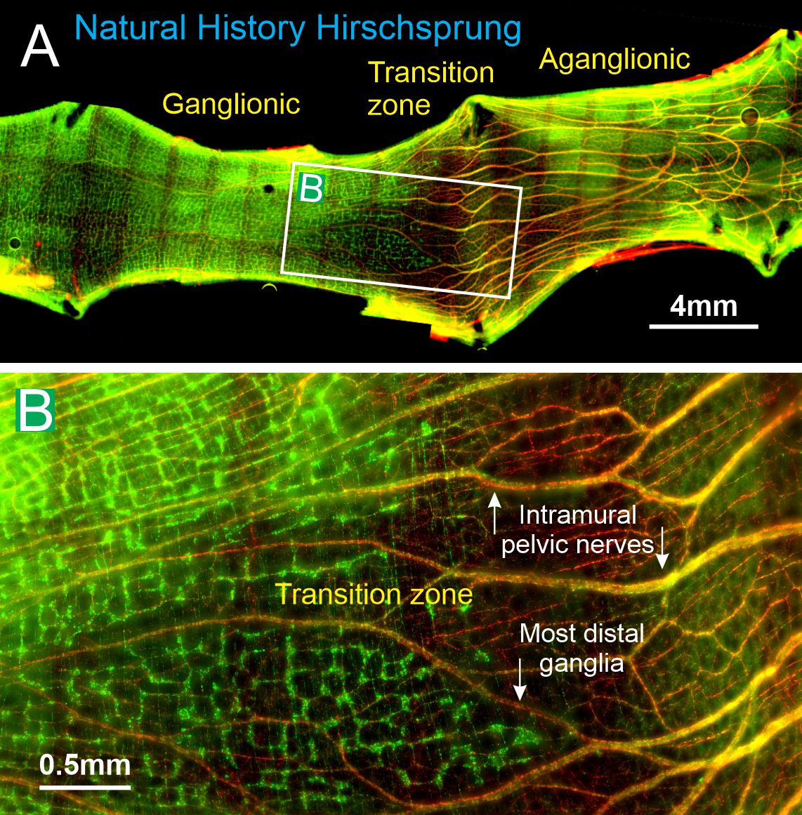 TheFurnessLab's tweet photo. Getting to the bottom of Hirschsprung Disease! 
The first Natural History overview of disease progression and development in rat after rescue surgery!🐀

Check it out here 📄➡️ https://t.co/dqcFnMcz5v

@UniMelbMDHS @TheFlorey @stampintino https://t.co/990FSB8xQ8