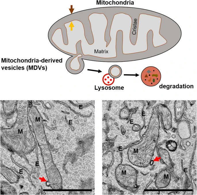 MedTech_Doc's tweet image. During periods of IM fasting, the body activates a cellular repair process called autophagy,  which removes damaged cells and generates new ones. This process can  help protect against diseases like cancer and Alzheimer's. #IntermittentFasting #Autophagy #CellularRepair #Cancer