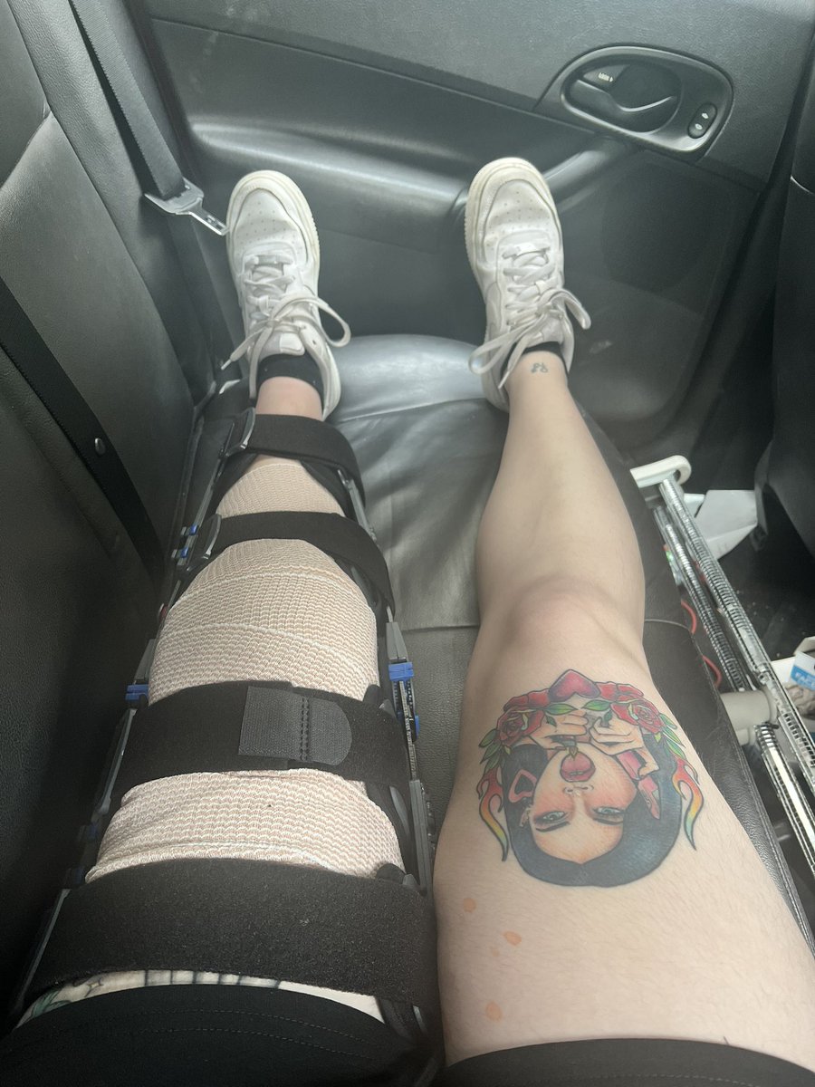 grlpwrart's tweet photo. hey y’all! I had acl reconstruction surgery 4 days ago after it was torn at a concert in November lol. 

Concert etiquette is absolutely dead and so is my entire leg! Waiting &amp; wishing for this to be over- and Im gonna have a sale soon to offset some of my hospital stuff :’) https://t.co/6W3yq876Qh