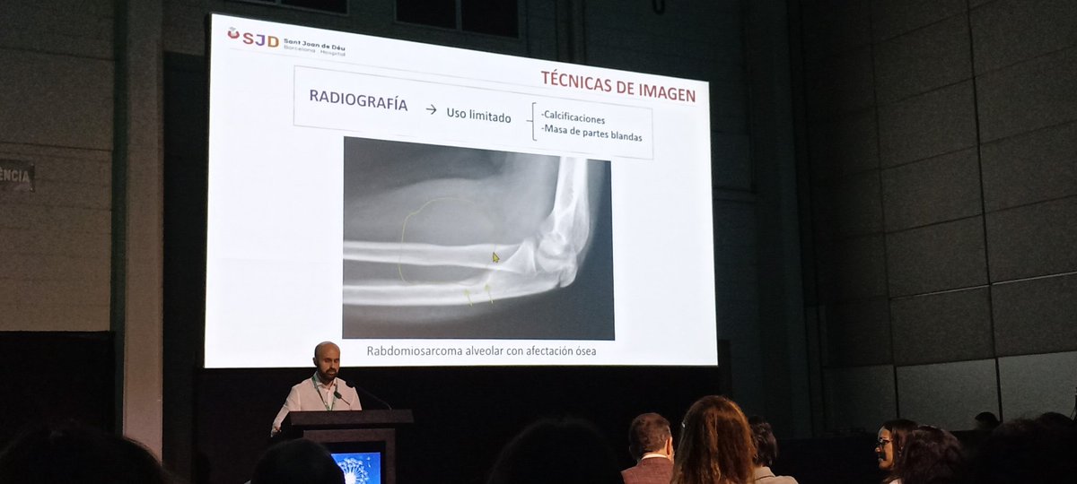 FLipsich's tweet photo. Always a pleasure to hear lectures from a brilliant radiologist like Dr @emilioinarejos.

#JPR2023 #SLARP https://t.co/qhlm509Doi