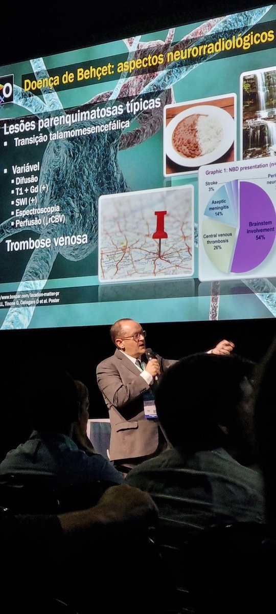 rad_wenger's tweet photo. Learning neuroBehcet with the amazing talk of @LucatoLeandro 🙌#jpr2023 #neurorx https://t.co/1EGm8YzsGG