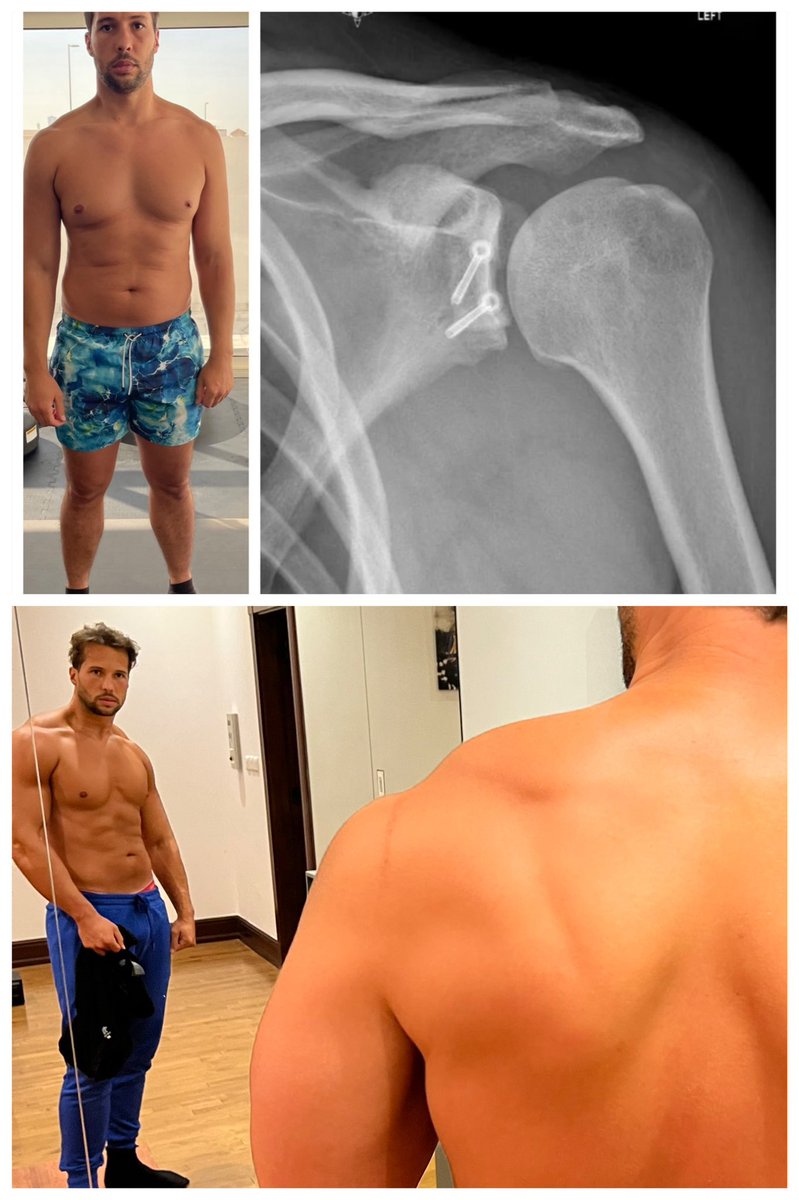 THE BLACK MAGIC BEHIND TRISTAN’S TRANSFORMATION

At the time everyone was saying steroids etc

But very few know the wizard who made that possible

We're revealing everything TODAY

RT this tweet and comment “SPELL” and we'lI DM it to you

Must be following to allow DM
(24h only)