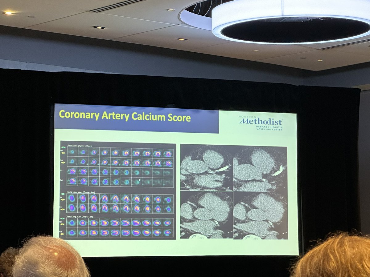 Bruno Lima (@brunolimamdphd) on Twitter photo Dr <a href="/almallahmo/">Mouaz Al-Mallah, M.D MSc</a> on CT attenuation correction (AC) on SPECT at <a href="/MyASNC/">ASNC Society</a> NC Today:
⭐️AC greatly improves sensitivity and specificity in pts with BMI>30
⭐️Adding a calcium score (CAC) and or estimated CAC (mild, mod, sev) adds to #CVNuc prognosis
⭐️Detect incidentals (lung CA, etc) Dr <a href="/almallahmo/">Mouaz Al-Mallah, M.D MSc</a> on CT attenuation correction (AC) on SPECT at <a href="/MyASNC/">ASNC Society</a> NC Today:
⭐️AC greatly improves sensitivity and specificity in pts with BMI>30
⭐️Adding a calcium score (CAC) and or estimated CAC (mild, mod, sev) adds to #CVNuc prognosis
⭐️Detect incidentals (lung CA, etc)