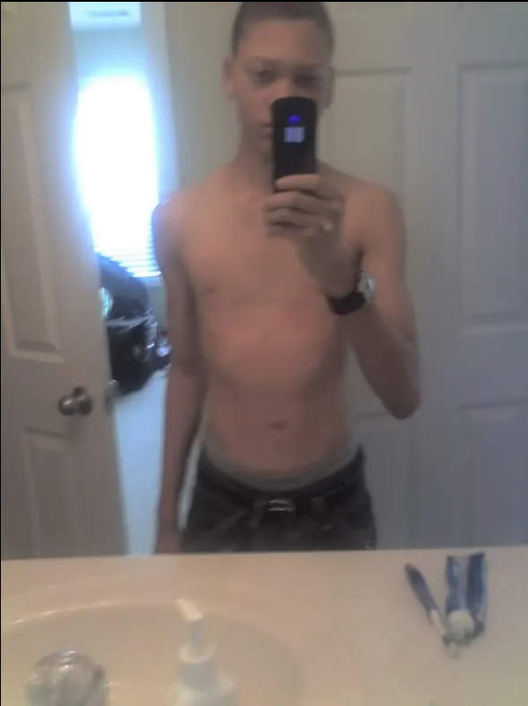 BDavonte's tweet photo. Folks are talking more about Pectus Excavatum (Sunken Chest) and the procedure to fix it because Steven Crowder got the procedure done while his wife was in labor having his kids.

So naturally, I would like to share that I TOO have/had Pectus excavatum and a rarer form at that https://t.co/y7pLwvIHlx