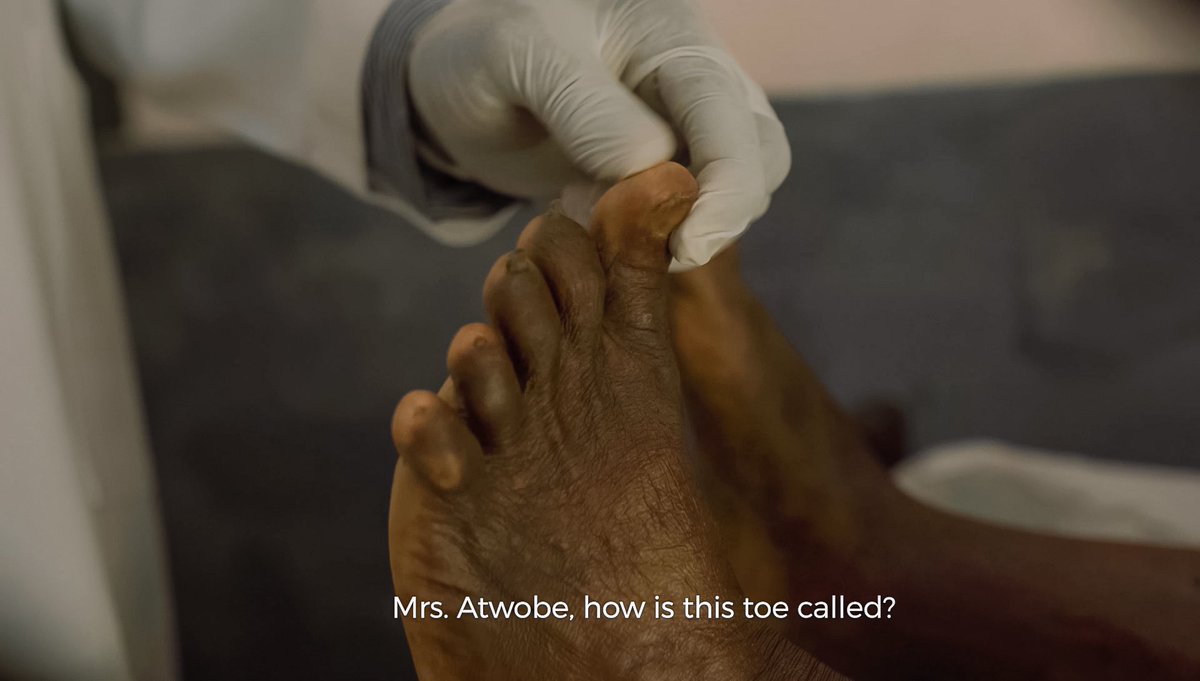 sirkwame_'s tweet photo. From my 1st Documentary on the prevalence of Diabetes in Rural Areas for NURDIC &amp; the World Diabetes Foundation 🩸 https://t.co/WURZF39Isc
