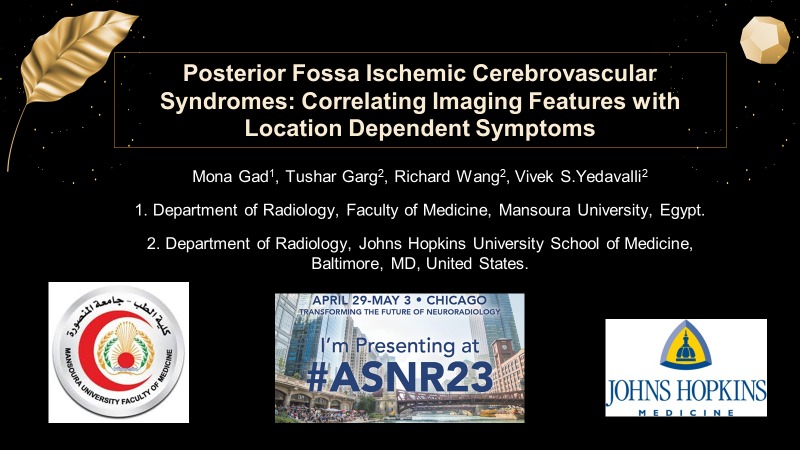 Proud to participate in #ASNR2023.
Don't miss our presentation on posterior fossa ischemic syndromes!🧠