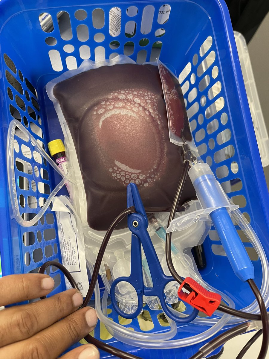True_Brownii's tweet photo. #SaveALife by #DonatingBlood @GiveBloodNHS @BloodDonorsEU
@SickleCellUK
{Especially:
#B+/- #A+/-
and/or if you have the #RoSubtype)
#BloodDonors #PleaseDonateYourBlood be a…
#LifeSaver
#GiveBlood
#BloodTransfusion
#Help #SickleCell suffers in need
#VitalBloodDonations https://t.co/3vuMzj1dD1