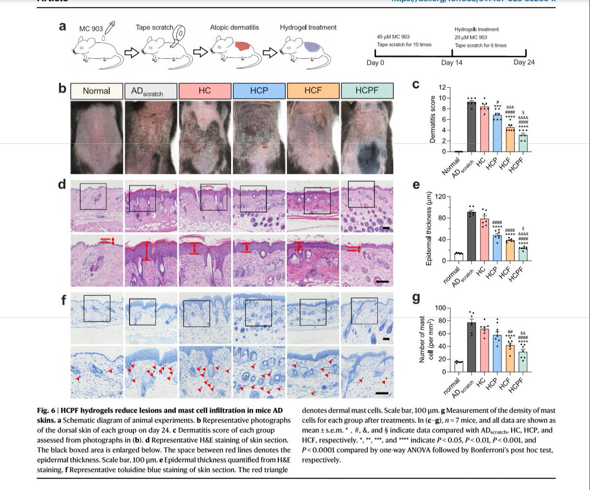 CrozrX's tweet photo. 🎯 Clinical translational promise of FAK as a mechanotherapy target.
•
Hydrogel dressing integrating FAK inhibition and ROS scavenging for mechano-chemical treatment of atopic dermatitis #AD #RAD2023 #eczema #defactinib
•
https://t.co/a9IjRbwPBt https://t.co/MBqj8ByKWZ