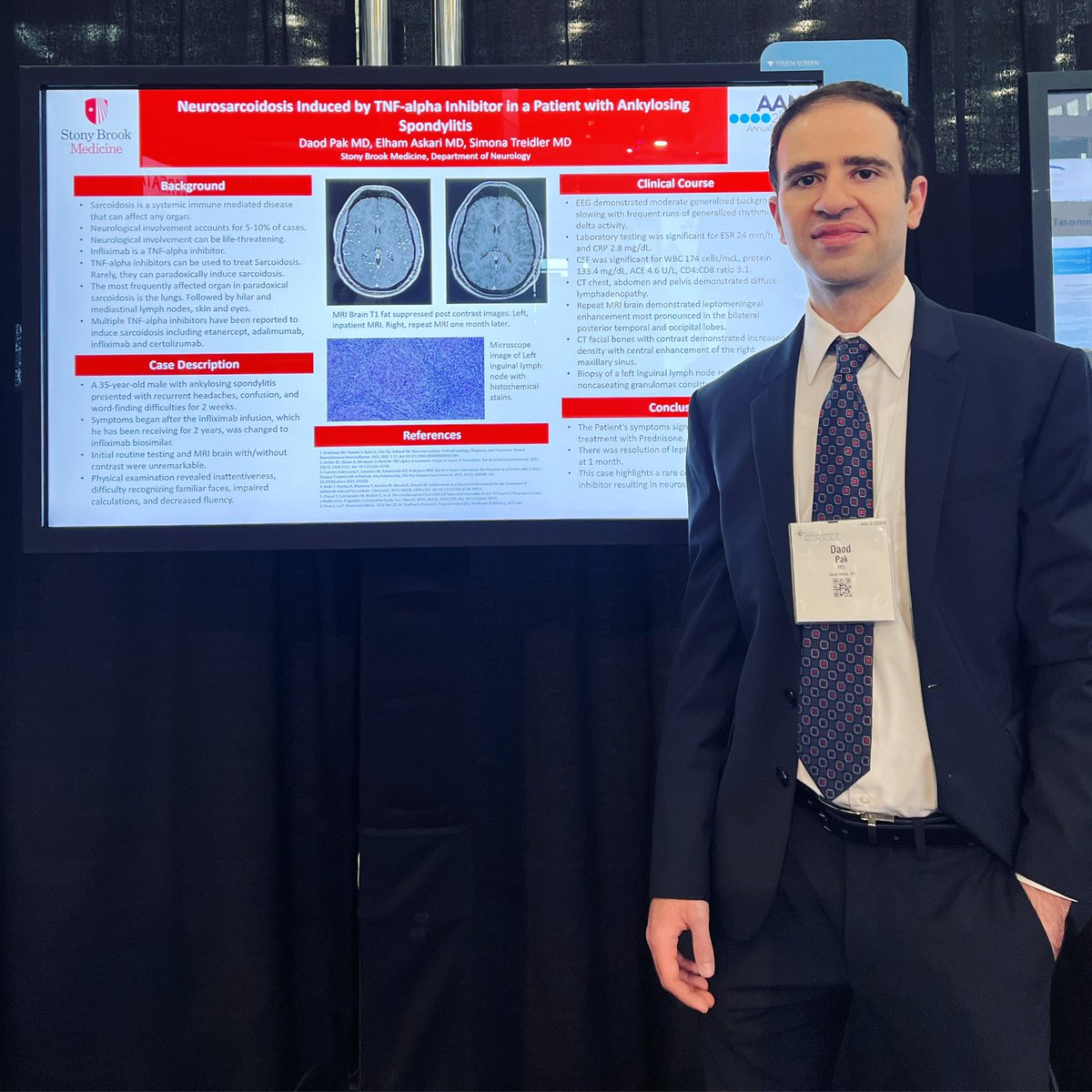 Congratulations to Dr Daod Pak on presenting his poster @ #AANAM!! So proud of you 👏👏👏!!! Shout out to Dr Elham Askari as well!! 🧠🤓🧠🤓🧠
 #aanbrain #manøfthehøur #stonybrookneuro #aan #neurosarcoidosis #research #neurologyresident #stonybrookmedicine #neurologyconference