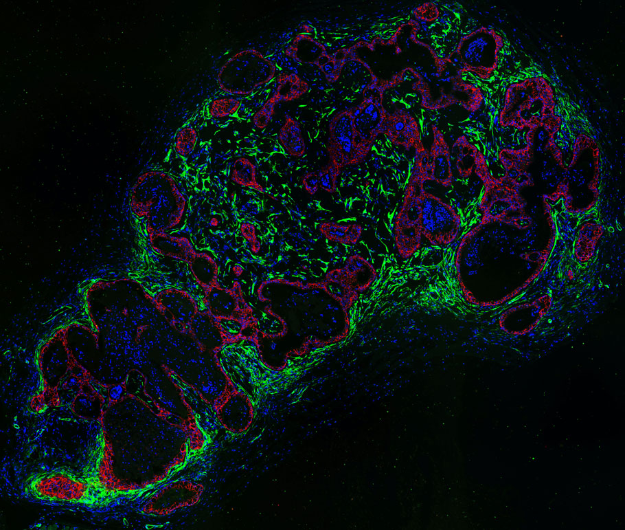 Harnessing single-cell cloning techniques, researchers at <a href="/BiologyUHgrads/">UH Biology & Biochemistry Graduate Programs</a> discovered an unusual #StemCell variant that contributes to #IdiopathicPulmonaryFibrosis by recruiting myofibroblasts, but that can also be targeted with EGFR inhibitors. scim.ag/2qp