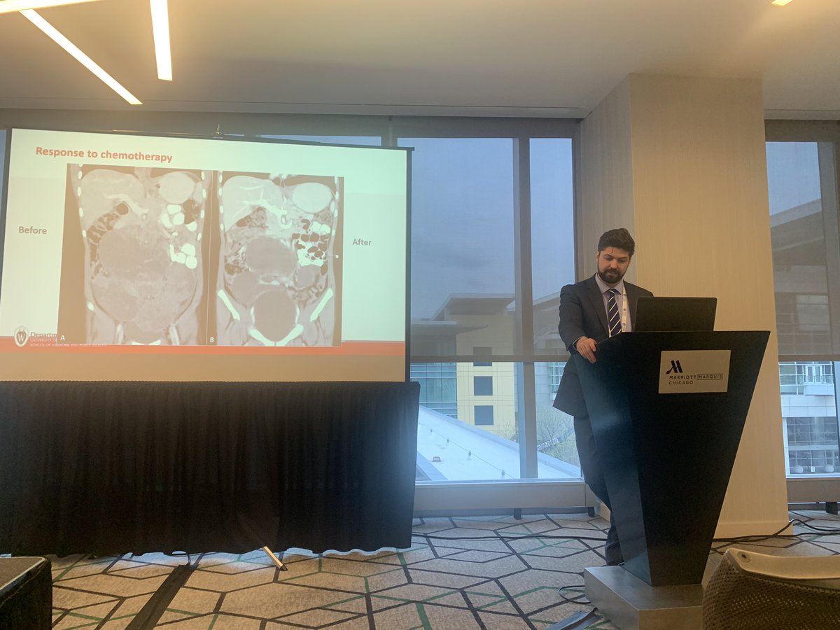 Teamwork for the win! Multidisciplinary care with complex GU reconstruction in a case of bilateral Wilms tumor. <a href="/SPU_Urology/">SPU_Urology</a> #AUA23