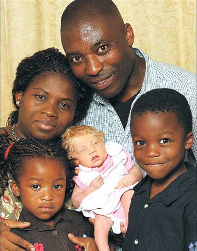 En 2010, un couple nigérian vivant à Londres a donné naissance à un bébé blanc, aux cheveux blonds et aux yeux bleus qu'ils ont appelé « The Miracle Baby »