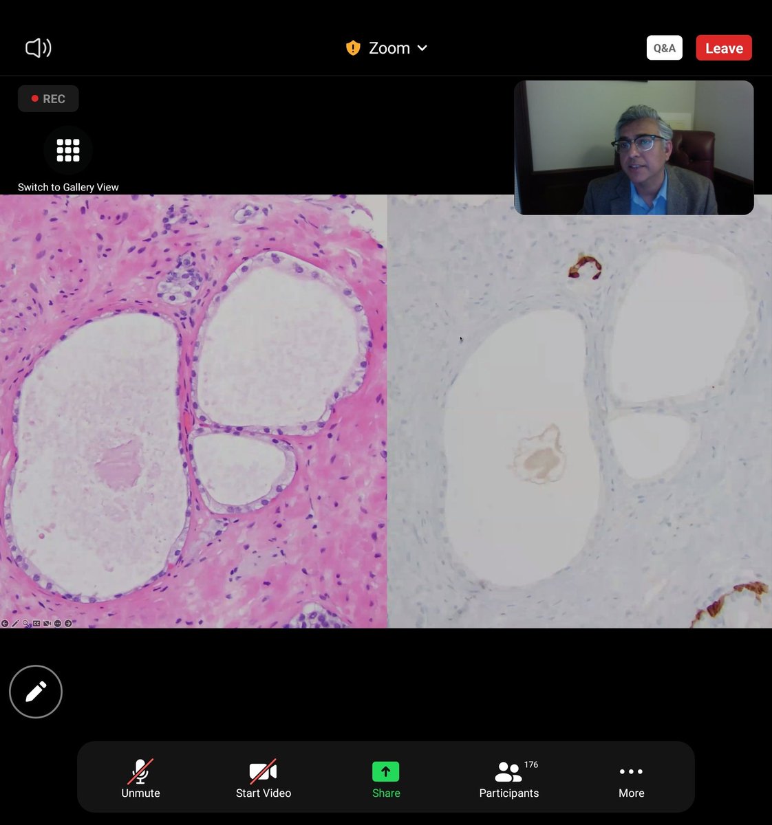 Akanksha Gupta, MD tweet media