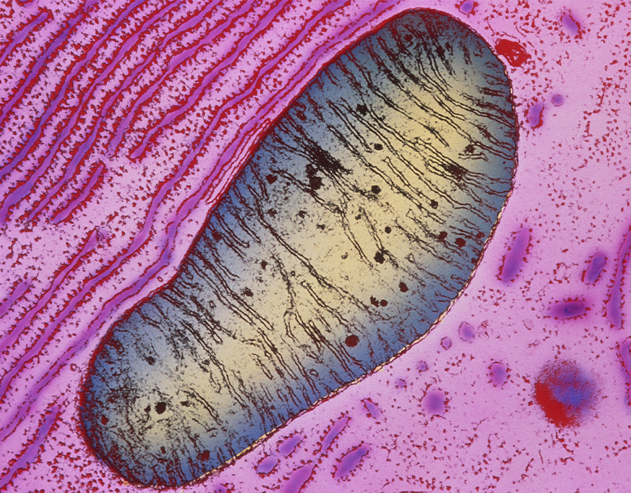 Science Immunology (@sciimmunology) on Twitter photo Chosen for #DayOfImmunology by editor @hmisles: This study found that Th17 cells cultured under OXPHOS conditions were resistant to apoptosis. This approach may be useful for improving T cell persistence in ACT immunotherapy. <a href="/_Hanna_Hong/">Hanna Hong</a> <a href="/LyssiotisLab/">Lyssiotis Lab</a>
scim.ag/2qz Chosen for #DayOfImmunology by editor @hmisles: This study found that Th17 cells cultured under OXPHOS conditions were resistant to apoptosis. This approach may be useful for improving T cell persistence in ACT immunotherapy. <a href="/_Hanna_Hong/">Hanna Hong</a> <a href="/LyssiotisLab/">Lyssiotis Lab</a>
scim.ag/2qz