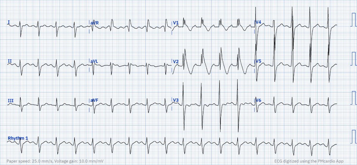 Brooks Walsh tweet media