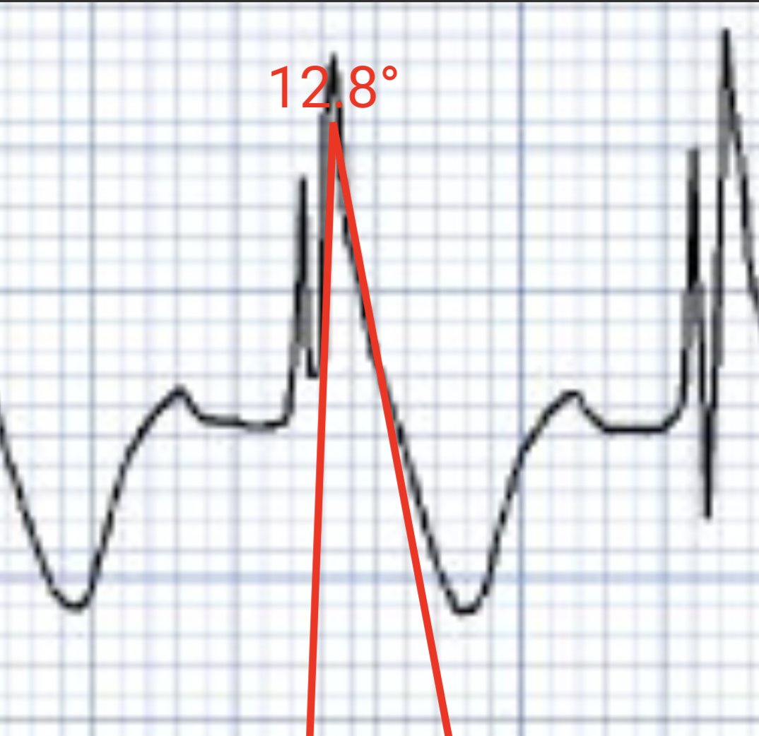 Brooks Walsh tweet media