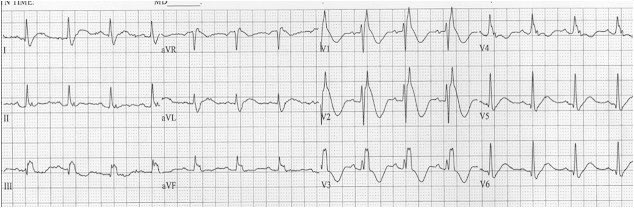 Kevin Butler tweet media