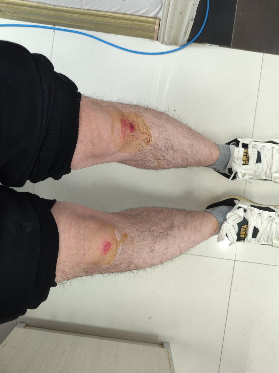 Dcaleor's tweet image. 😫