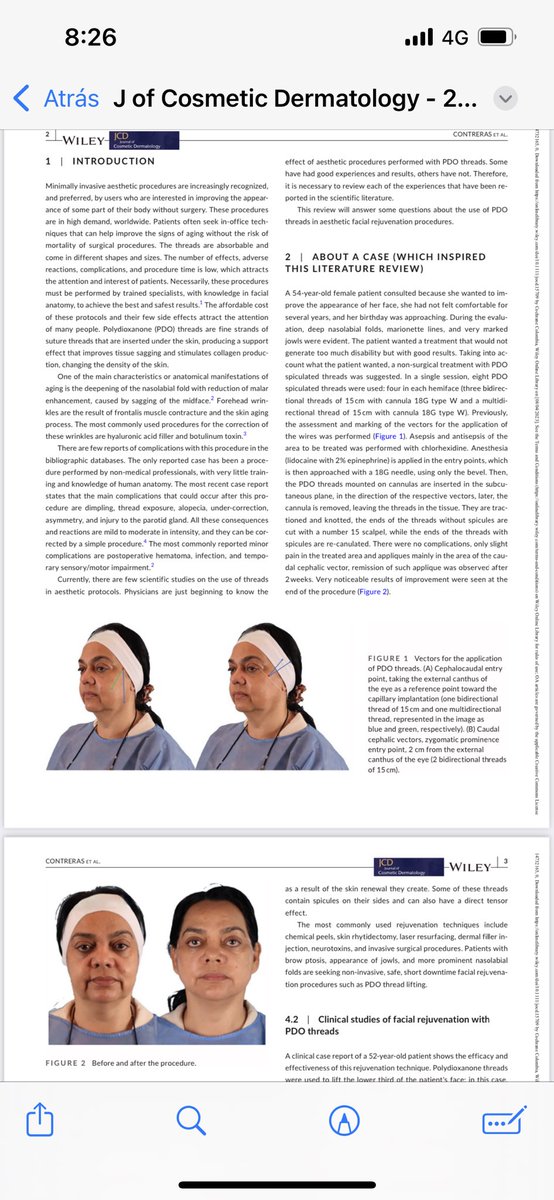 AminAriza's tweet photo. Felicitaciones a la Dra. @dracandeca por realizar la primera publicación en Medicina Estética de un médico estético y al resto del grupo de investigación de la Escuela por haber logrado esta gran meta científica @asomeca2017 @AasSpa @dermasthetic @Tisiquisiyork @ArizaNJuandavid https://t.co/Hwq1hKZ101