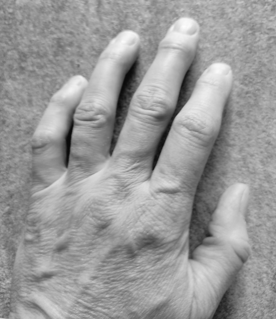 kletterphysio's tweet photo. Is continuing #climbing with #fingerpain safe?
While often dosed #loading of the #fingers can be beneficial, there are also reasons to have a complete break of climbing. As reasons of having pain are very various, there can only be solutions adapted to your personal situation! https://t.co/rUpV8shKjr