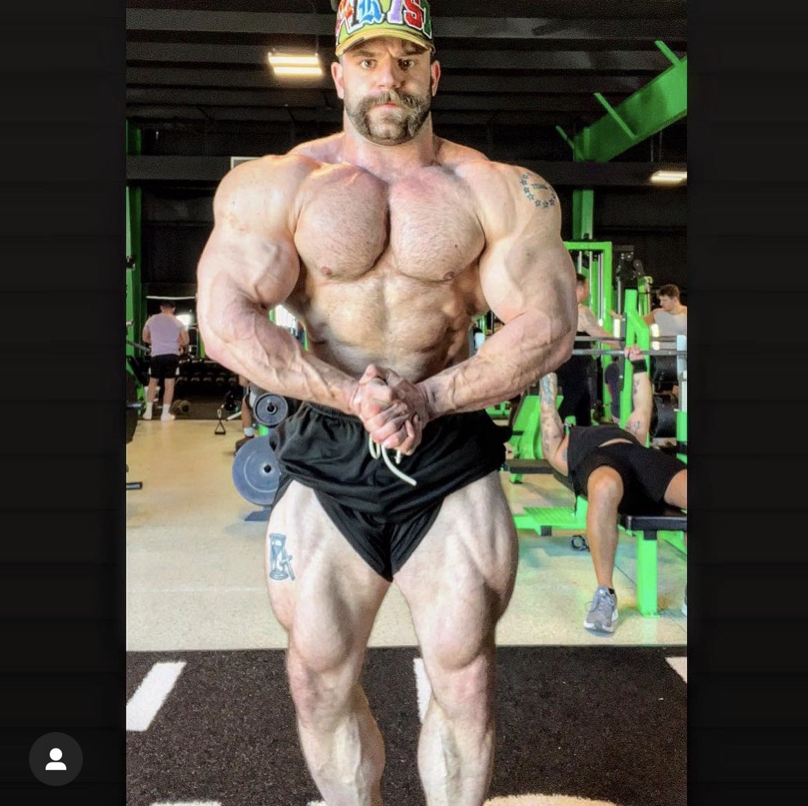 hairy_bb's tweet photo. Patrick Davis https://t.co/4CkJ9yQf2u