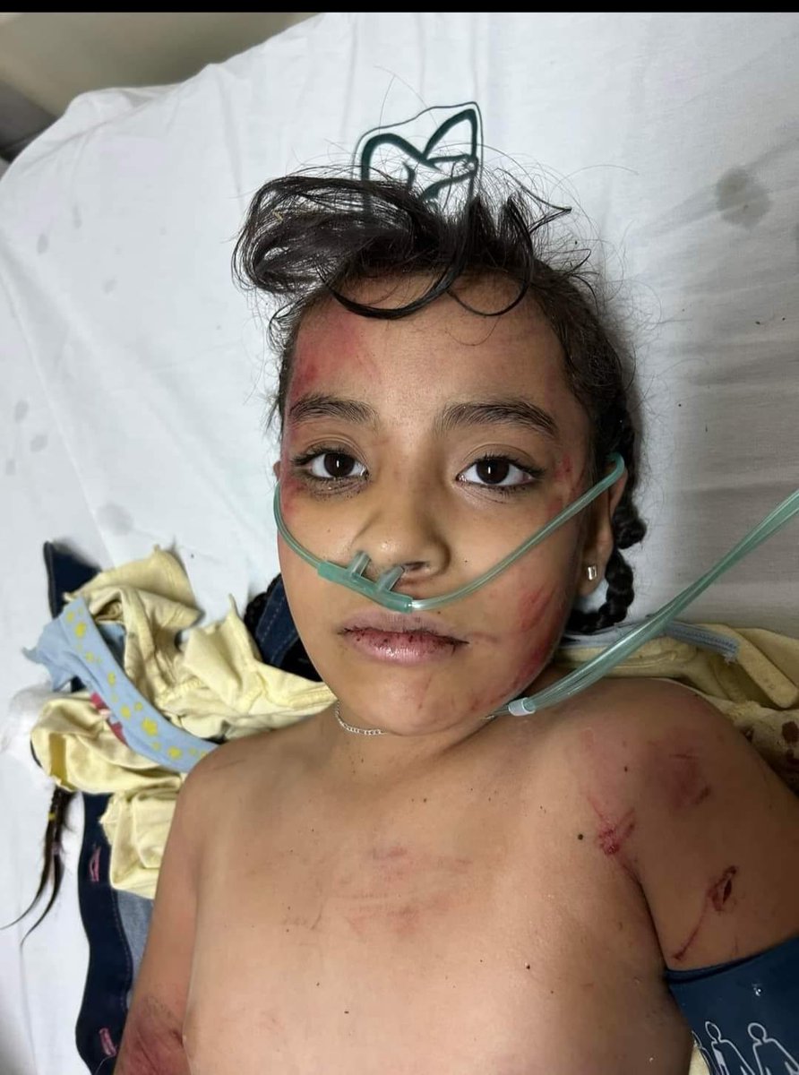 Servicio urgente tenemos a Sofía Belén Hdez Aparicio de 9 años de edad en servicio de Urgencias del HGZ 1 IMSS Tepic Nayarit, iba en el autobús accidentado en carretera Federal 200 cerca de Mesillas. Buscamos urgentemente a familiares