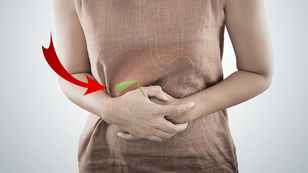 Why Do Gallstones Form?