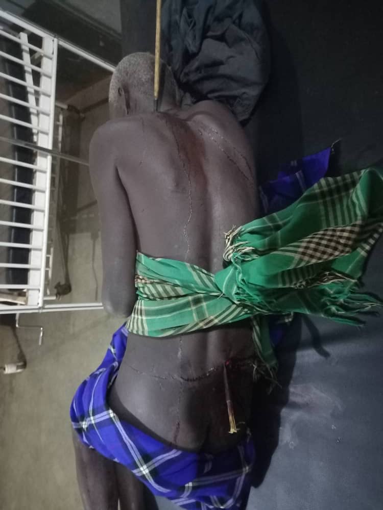RicOkello's tweet photo. This is the only warning about visiting Abim at the moment.
Karamojong cattle rustlers could put an arrow anywhere, be it your nyash, boobs, face, or whatever.
These are not pictures from Sudan or DRC. They are from the Pearl of Africa. #AbimIsBleeding https://t.co/nyiMQJSqNB