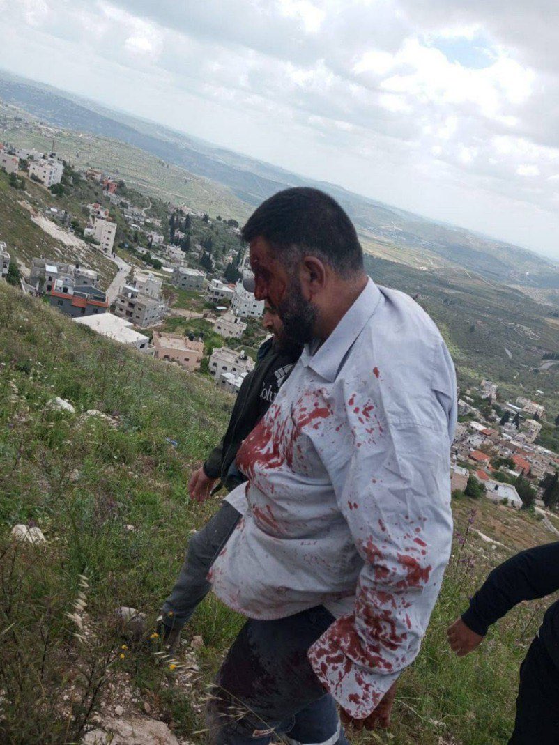 Timesofgaza's tweet photo. Palestinian man sustains serious injuries due to being assaulted by lsraeli colonial settlers near Burqa, north of Nablus. https://t.co/OeWLtCBi0K