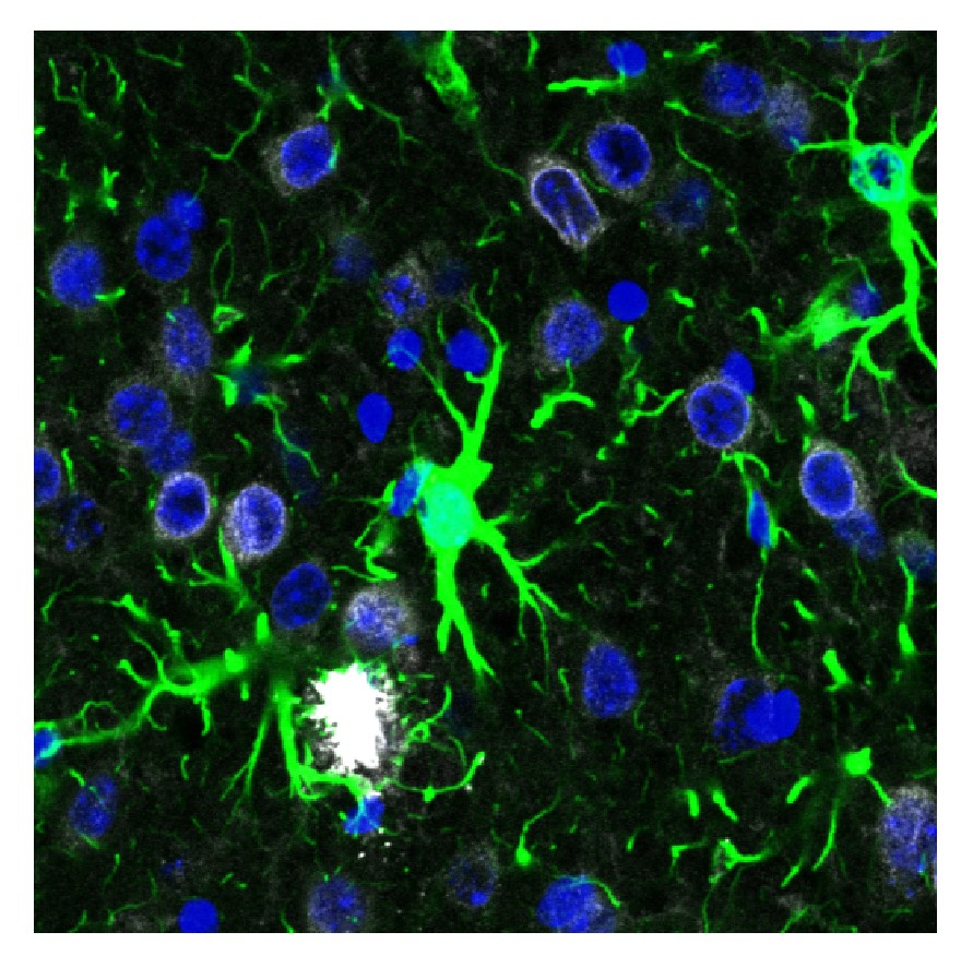 patrizialazzar7's tweet photo. Alzheimer: alterazioni molecolari negli astrociti condizionano il cervello  LEGGI su https://t.co/fkJBKAQsBq https://t.co/7VskIxez66
