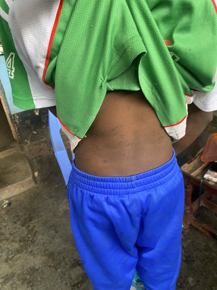 kiberapride's tweet photo. No child should ever have to go through such cruelty. We are grateful that he was rescued and he is in safe hands. Let's all come together and show our love and support for this child and all others who have been victims of abuse. ❤️
#ChildAbuseMustStop
#childrenrights https://t.co/GS2yiRRlNi