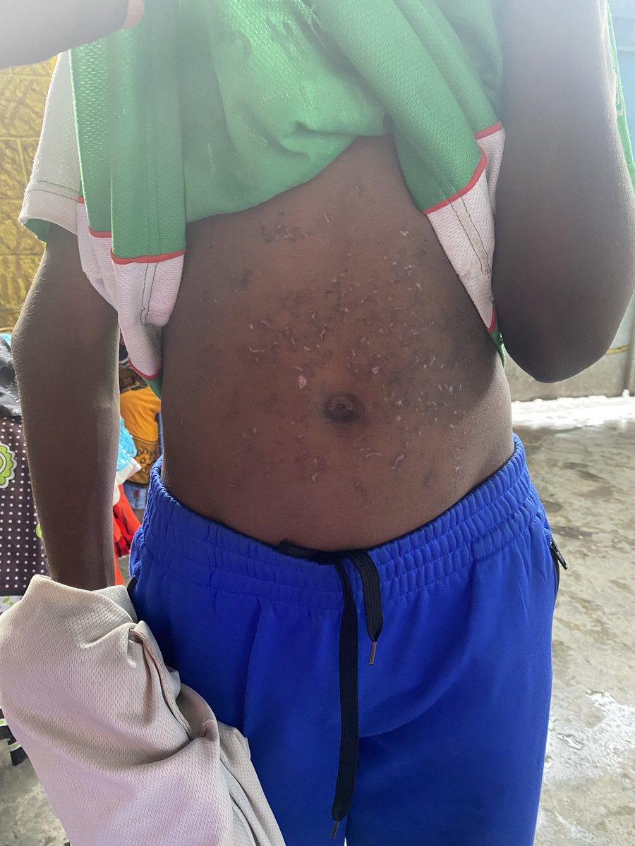 kiberapride's tweet photo. No child should ever have to go through such cruelty. We are grateful that he was rescued and he is in safe hands. Let's all come together and show our love and support for this child and all others who have been victims of abuse. ❤️
#ChildAbuseMustStop
#childrenrights https://t.co/GS2yiRRlNi