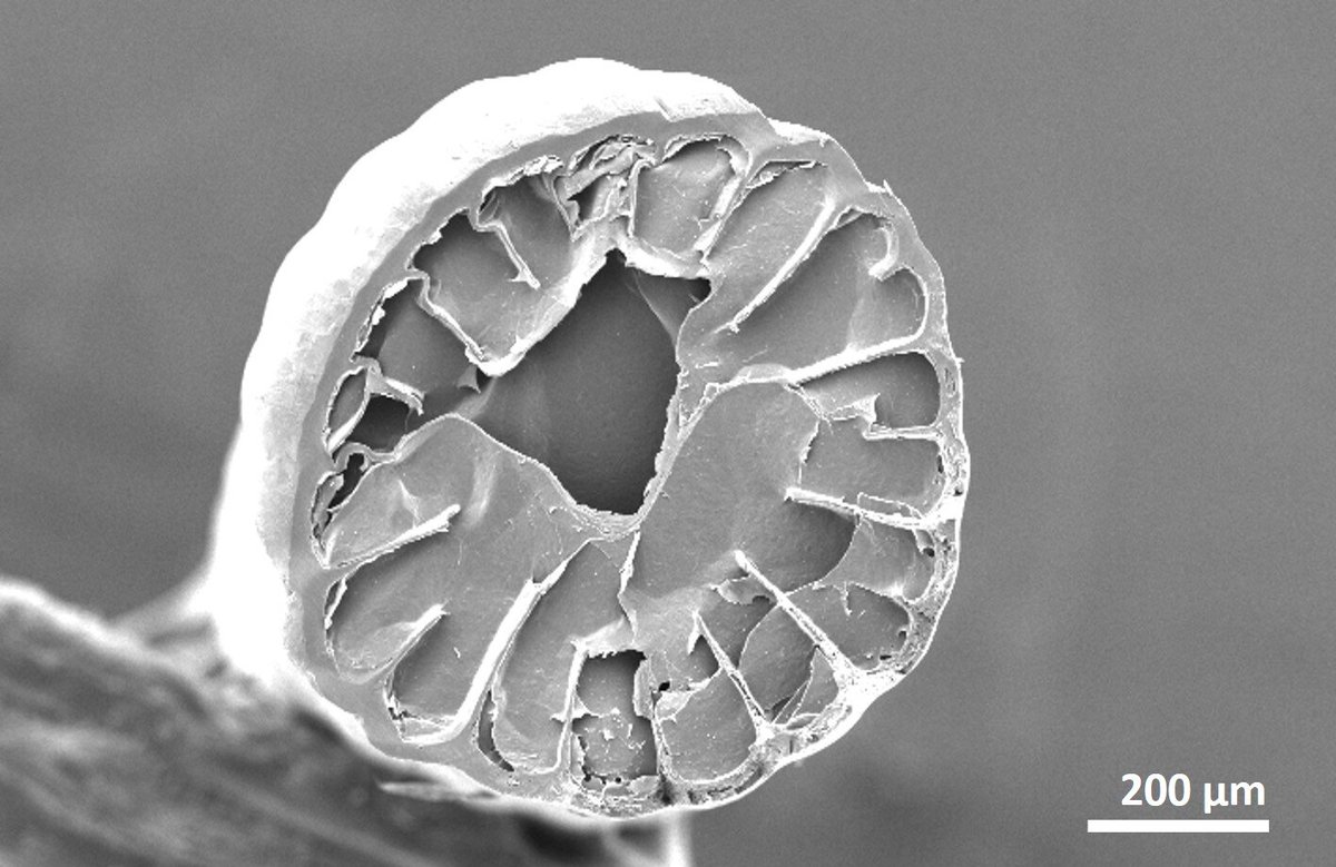 UoNPressOffice's tweet image. Ever wondered what the inside of a Hedgehog spine looks like? 

Experts from @UoNnmRC have imaged one to mark #Hedgehogawarenessweek @UoNScience , @physorg_com reports.

Read more ▶️ phys.org/news/2023-04-s…