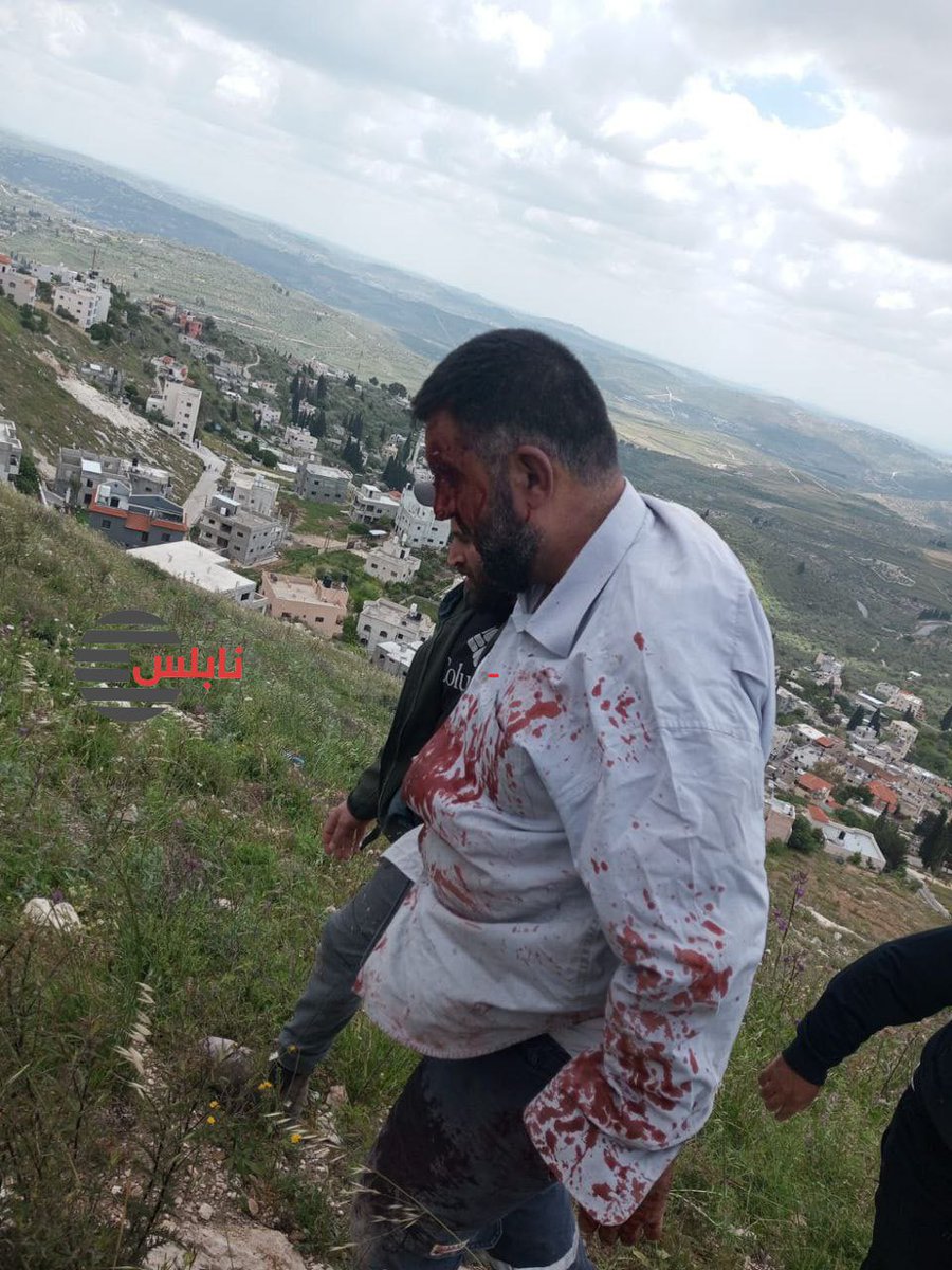 ytirawi's tweet photo. Burka, Nablus

Israeli settlers attacked a Palestinian from the town who came to confront the settlers who attacked his properties at the outskirts of the town. https://t.co/bsG258JgdS