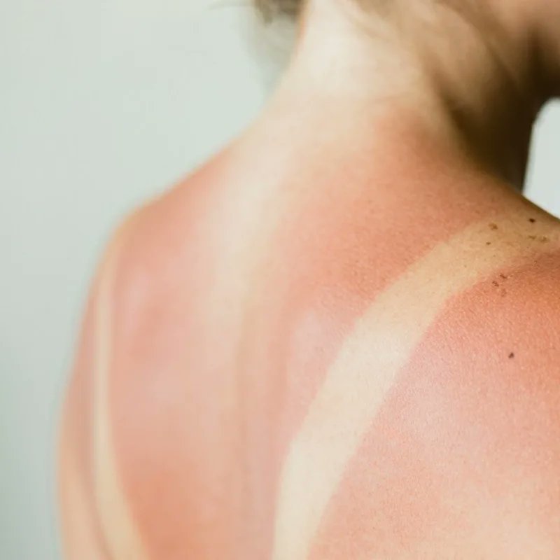 yourskin237's tweet photo. PRÉVENTION DES COUPS DE SOLEIL avec un crème solaire. 

La crème solaire MINÉRALE hydratante CERAVE a un FPS( Facteur de Protection Solaire) de 30. 

Appliquez cet écran solaire deux fois par jour.
-----
 #ProtectionSolaire #FPS  #Cerave  #YOUR_SKIN https://t.co/yyaiQNOkGZ