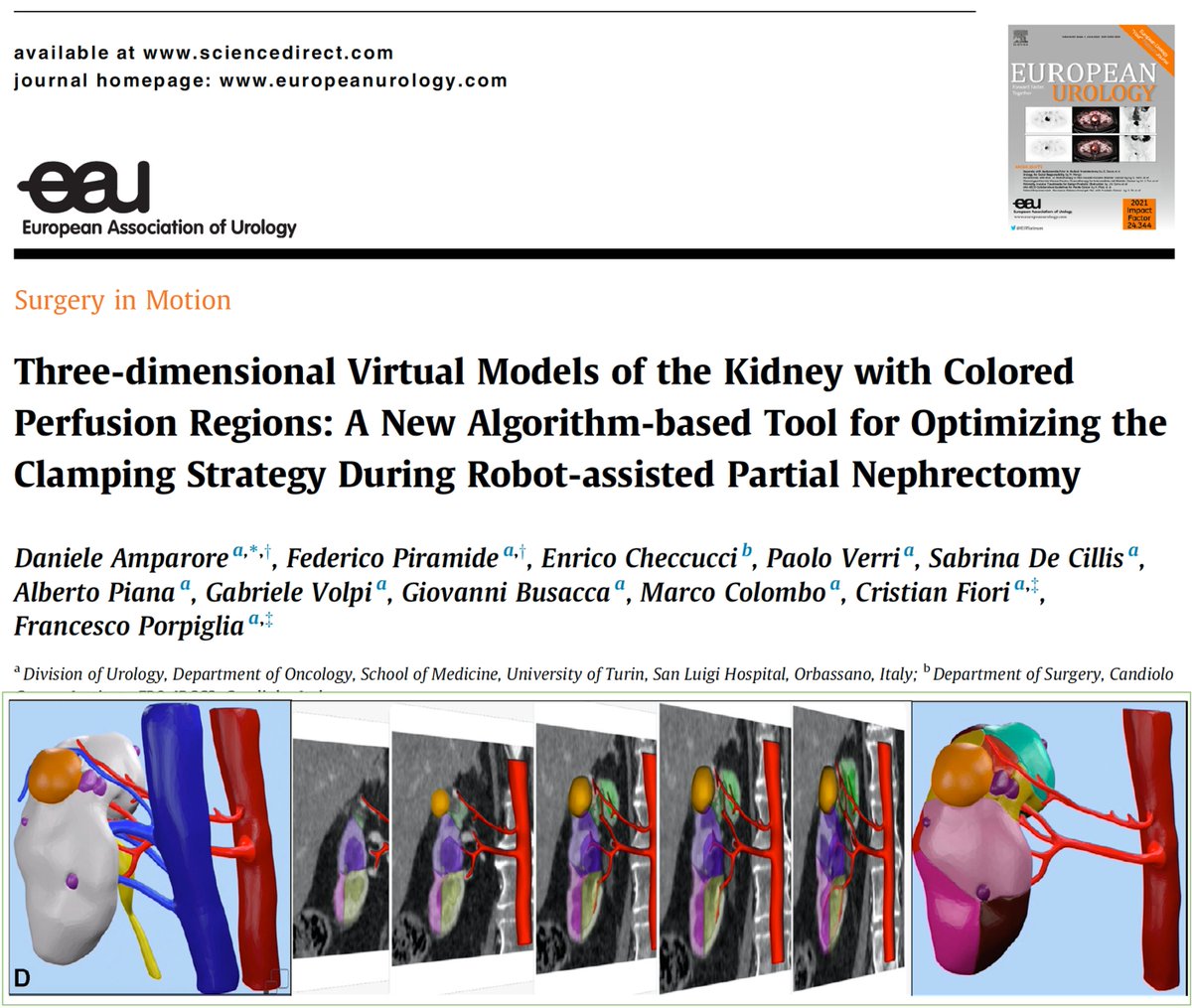 danieleamparore's tweet photo. Proud to share the results of two-year research on #3dmodeling in #kidney #Cancer #Robotics #surgery: the new generation of #virtualmodel with perfusion details allows to maximize selective clamping efficacy!  @EUplatinum @Uroweb @Medics3D @PorpigliaF 

👉https://t.co/cO8a3VtYte https://t.co/odFkYhODUV