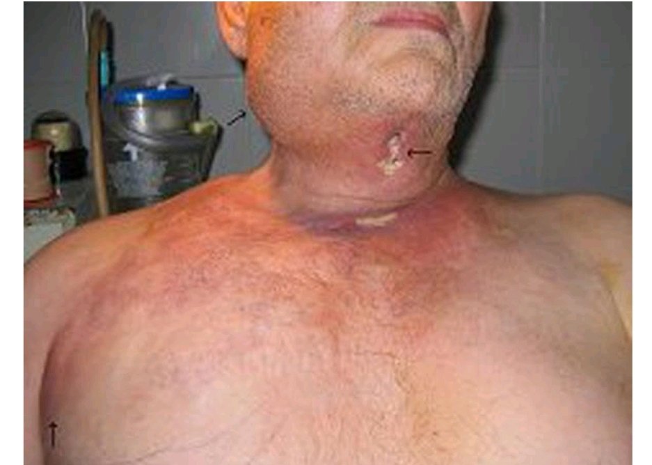 Dr.Hakan Akelma 🩺 tweet media