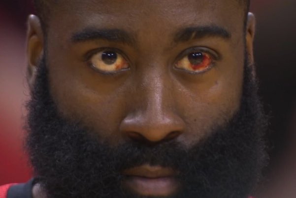 VatorSports's tweet photo. I still remember the time Draymond Green poked James Harden in the eye. 

I’d think this was an accident if I didn’t know better. https://t.co/DVDYIERi9Y