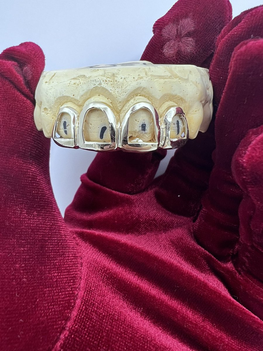 ayomobb's tweet image. Custom 4 top grillz 😁 dm when your ready to get slugged up #grillz #customwork #gold