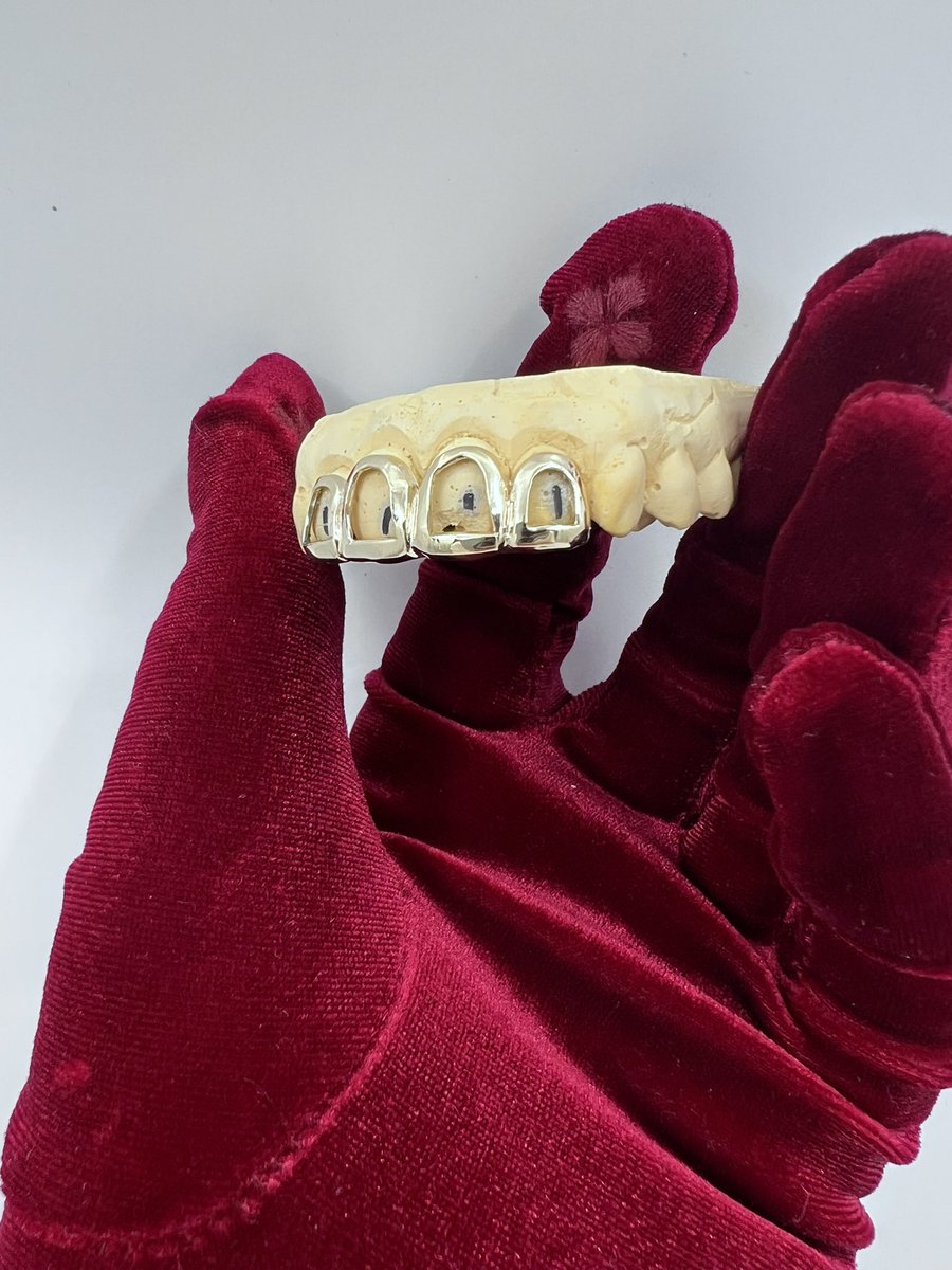 ayomobb's tweet image. Custom 4 top grillz 😁 dm when your ready to get slugged up #grillz #customwork #gold