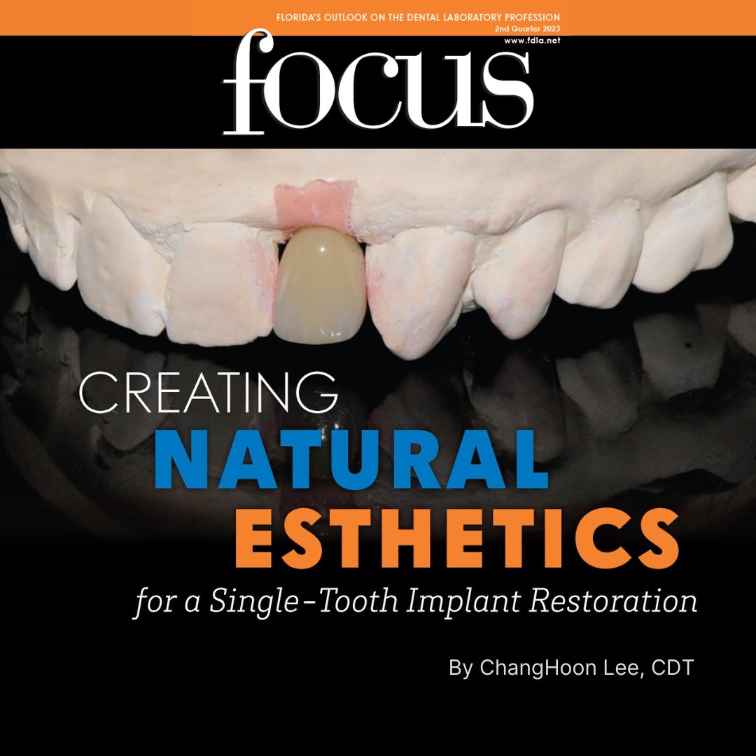 How are you satisfying demand for restorations that are both screw-retained and esthetic? See the technology &amp; techniques employed: info.preat.com/creating-natur…

Learn more from the author at his seminar at Lab Day West on Optimal Anterior Aesthetics with Angled Screw Channels!