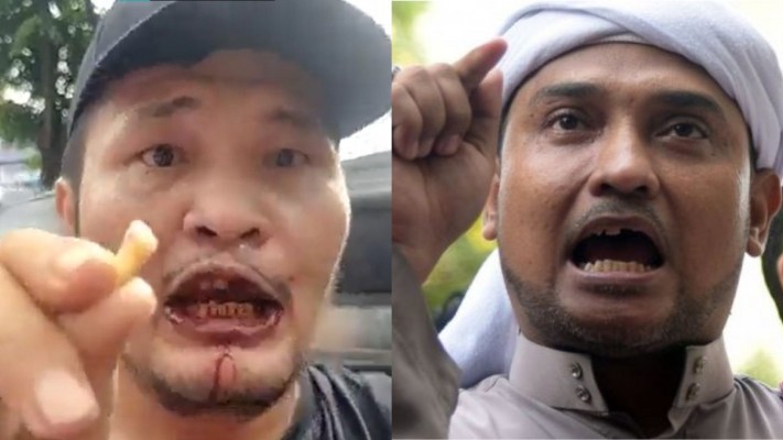 AB_008_'s tweet photo. Eh Prosesor @musniumar 
Kau lagi ngomongin si Ompong Nicho @Migran_TV_7777 sama si Ompong Novel ya???

Awas loe...
Tar kena gigit mereka,
Bisa tetanus lho.
.
.
.
📌 https://t.co/6BwggRI4nS