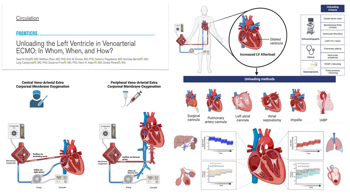 M Velia Antonini (@foamecmo) on Twitter photo Unloading LV in VA #ECMO:
🎈 physiological basis
🔮 whom to unload? hemodynamic, #POCUS & clinical predictors
⚙️ how to unload? noninvasive and pharmacological approaches, venting & unloading strategies
⏰ when to unload?
➡️ unloading targets
<a href="/CircAHA/">Circulation</a>
🖇️ bit.ly/3A9BjIQ Unloading LV in VA #ECMO:
🎈 physiological basis
🔮 whom to unload? hemodynamic, #POCUS & clinical predictors
⚙️ how to unload? noninvasive and pharmacological approaches, venting & unloading strategies
⏰ when to unload?
➡️ unloading targets
<a href="/CircAHA/">Circulation</a>
🖇️ bit.ly/3A9BjIQ
