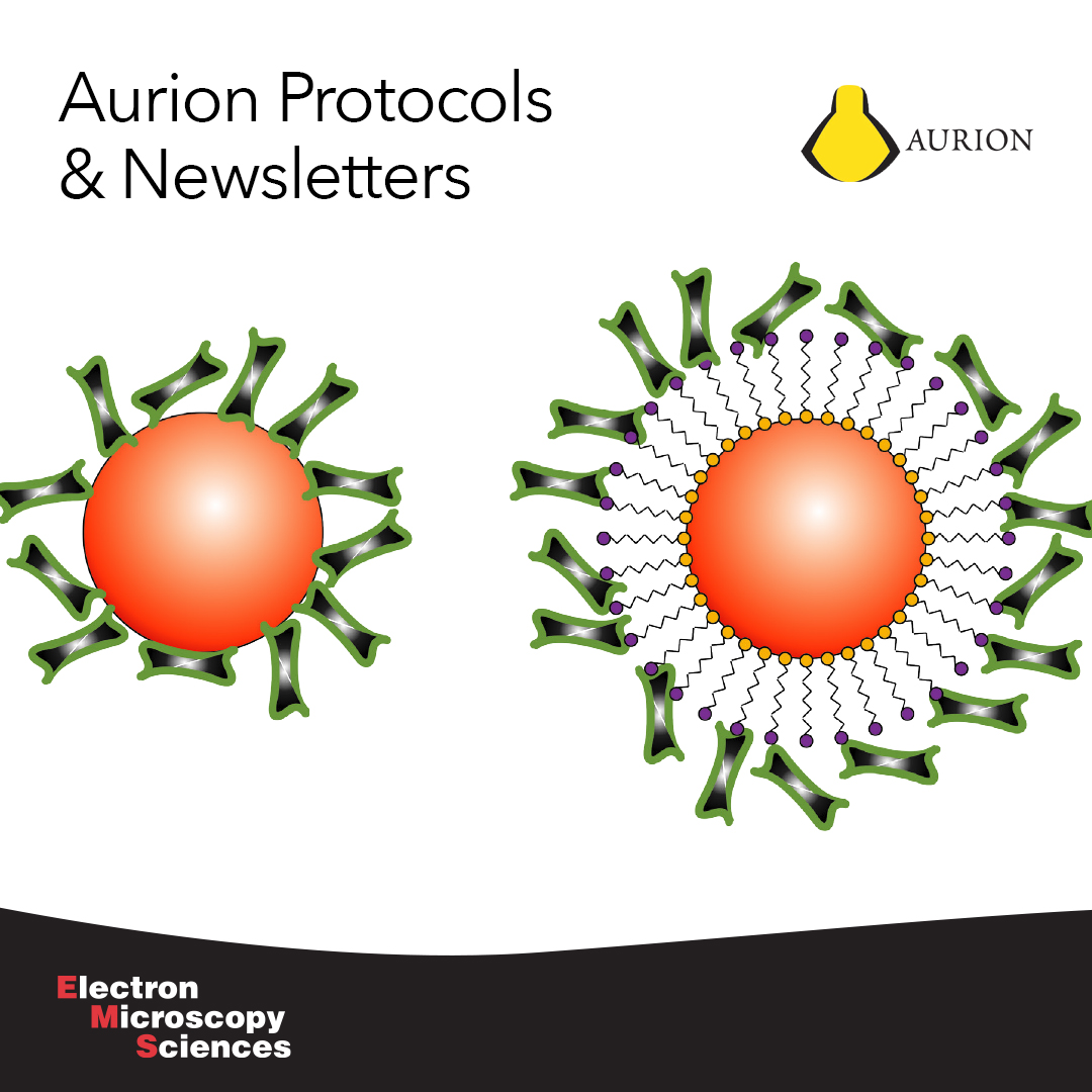 EMSDIASUM's tweet photo. Aurion has always been willing to share their expertise. Here is an overview with links to protocols, newsletters, and flyers. https://t.co/K3hyiWq6Uc

#EMShasit #aurion #immunogold #chemistry #histology #biology #electronmicroscopy #microscopy #microtomy #neuroscience #TEM #SEM https://t.co/Qh2t125Fps